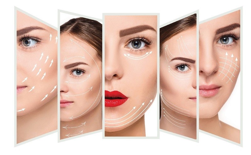 Phân loại theo hình dạng các loại chỉ căng da mặt